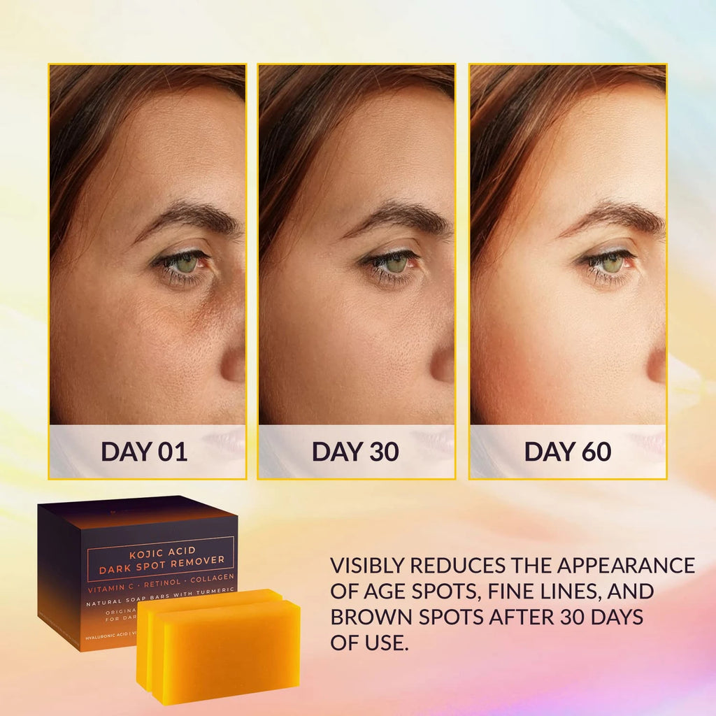 Kojic Acid Brightening soap